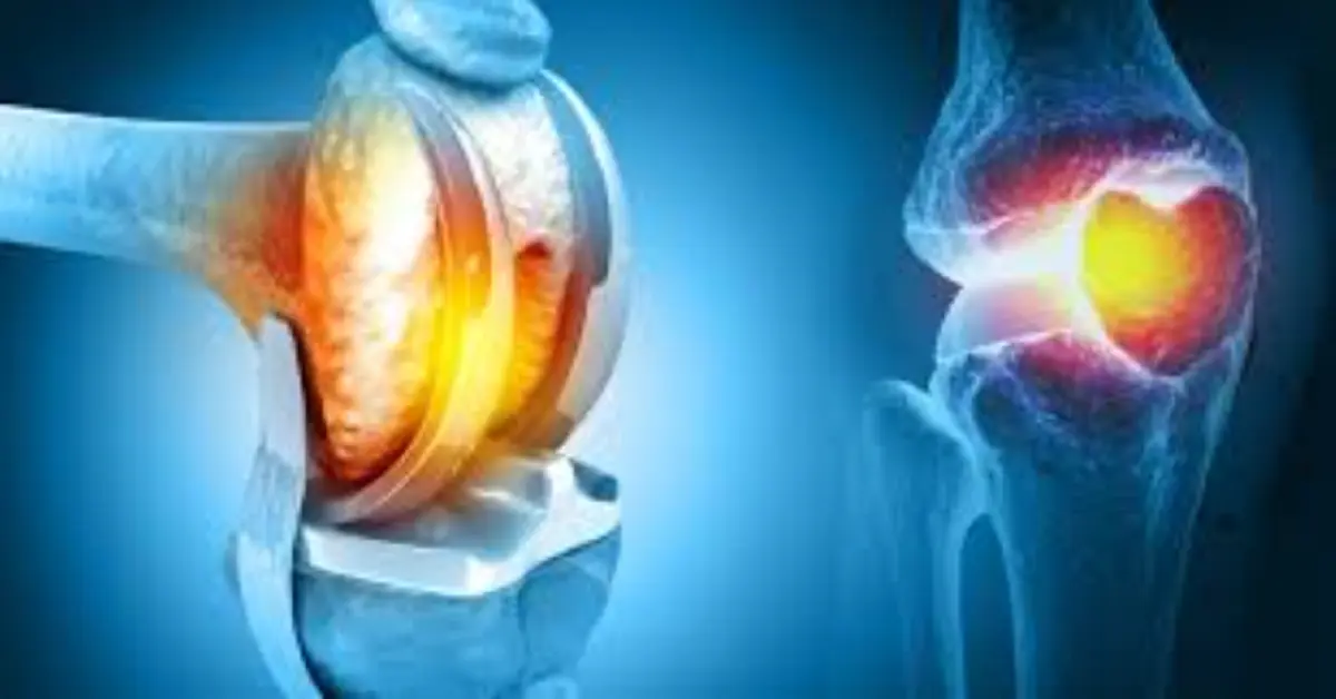 acibadem health point knee replacement